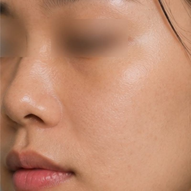 AI illustrative image — Before: Dry, lackluster skin